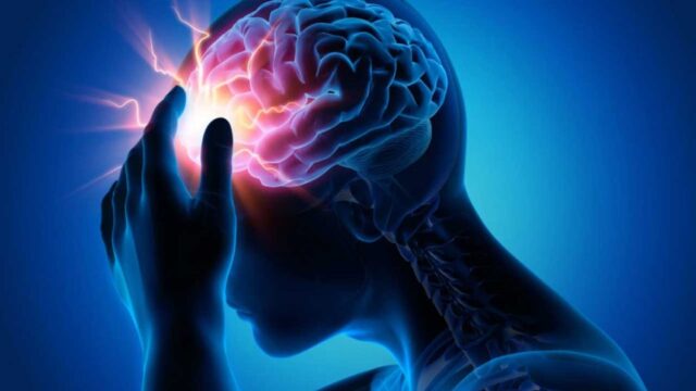 brainomixstroke-1062x598