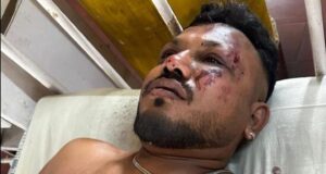 Air India Tragedy: Lone Survivor Recounts Horror Of Crash That Killed Over 240