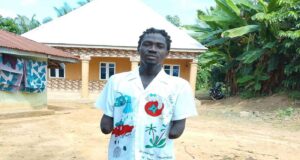 Ebonyi Man Recounts How He Lost Both Arms Trying To Save A Friend’s Shop