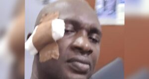 State Assembly Majority Leader Allegedly Smashes Beer Bottle On Colleague’s Head Over Governor’s Cash Gift