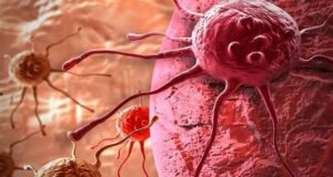 Jehovah’s Witness Cancer Patient Under Fire For Rejecting Blood Transfusion After N30m Donations