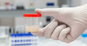 Nearly 200 Children Conceived From Sperm Donor Carrying Cancer-Linked Gene – Report